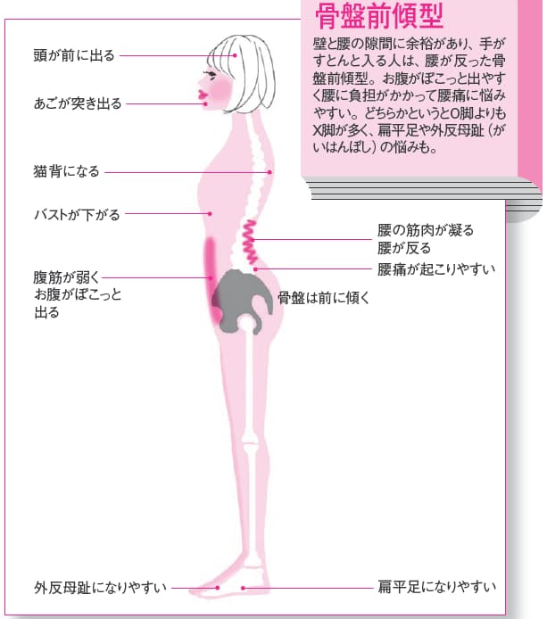 Japan Image 骨盤 前傾 後傾 どっち Japan Image 骨盤 前傾 後傾 どっち