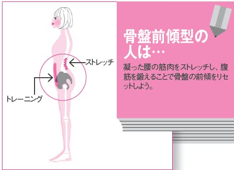 Japan Image 骨盤前傾 Japan Image 骨盤前傾