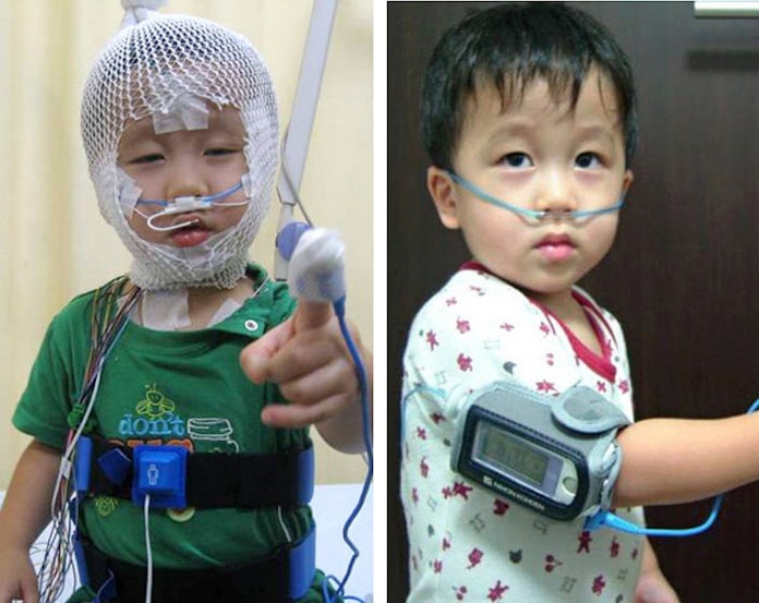 小児に広がる 睡眠時無呼吸 落ち着きなく粗暴に 日本経済新聞