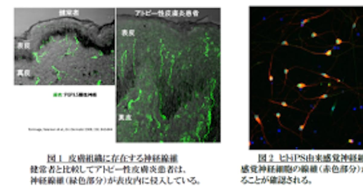 ファンケル 高精度のヒトips由来感覚神経細胞の作成に成功 日本経済新聞