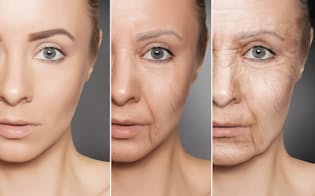 最近話題の「糖化」は老化要因の一つで、肌のハリやシワなどにも密接に関係している。写真はイメージ(c)transurfer-123RF