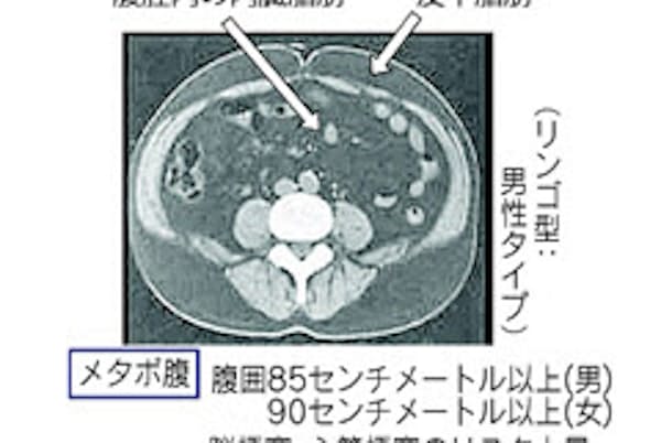 ポッコリおなかの原因と美腹のポイント 筋肉鍛え 姿勢正しく Nikkei Style