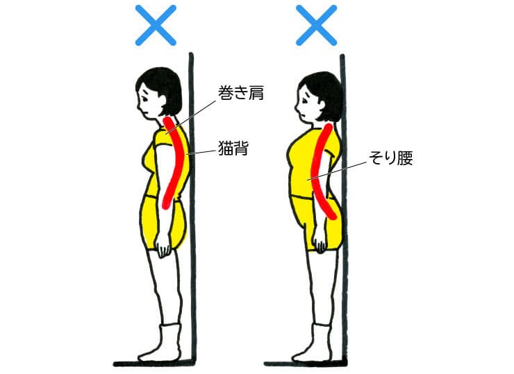 女性に多いのは そり腰 男性は 猫背 その腰痛 肩こり 膝痛 悪い歩き方 Nikkei Style 女性に多いのは そり腰 男性は 猫背 その腰痛 肩こり 膝痛 悪い歩き方 Nikkei Style