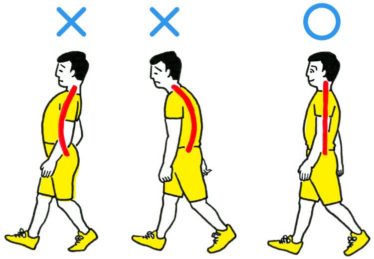 女性に多いのは そり腰 男性は 猫背 その腰痛 肩こり 膝痛 悪い歩き方 Nikkei Style 女性に多いのは そり腰 男性は 猫背 その腰痛 肩こり 膝痛 悪い歩き方 Nikkei Style