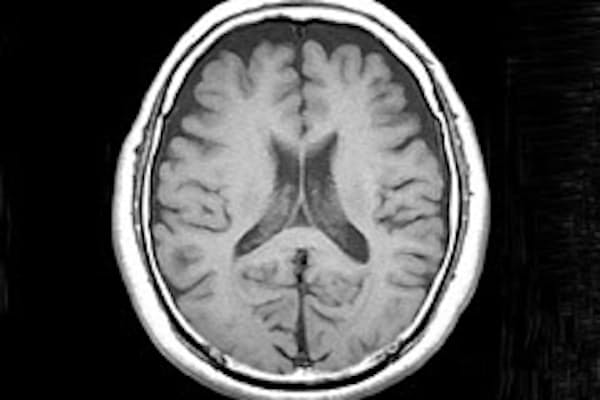 脳の中にある 物まね神経 のすごい働き Nikkei Style