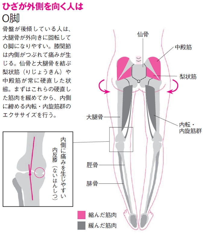 O脚 X脚を治して 脚長 小尻になる 日本経済新聞