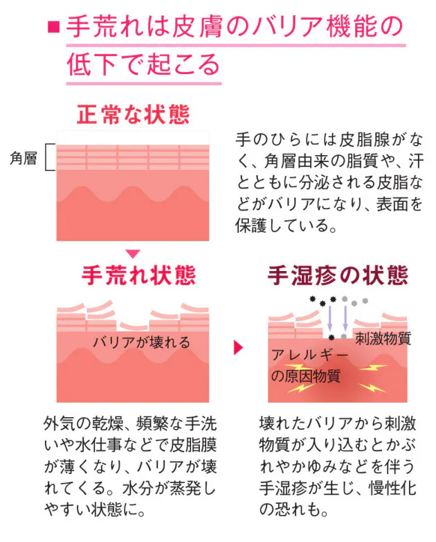 乾燥と冷えが手荒れの原因 軽症ならセルフケアで改善 Nikkei Style