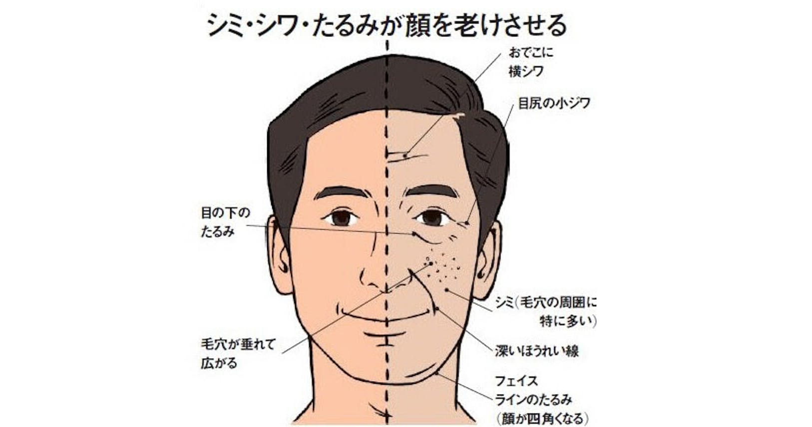 顔 の シミ を 取る 方法