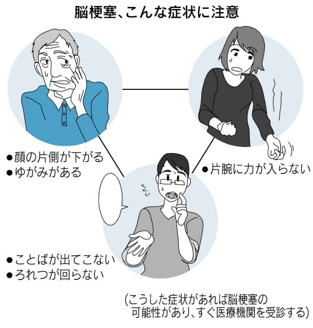熱中症だけじゃない 意外と多い夏の脳梗塞 脱水 血管詰まりやすく Nikkei Style 熱中症だけじゃない 意外と多い夏の脳梗塞 脱水 血管詰まりやすく Nikkei Style