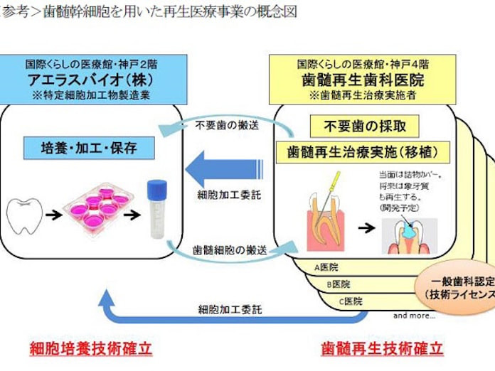 エア ウォーター 歯髄幹細胞を活用した歯髄再生治療の事業化に着手 日本経済新聞