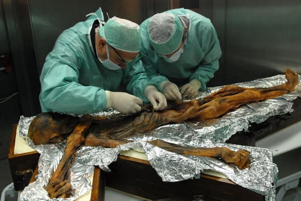 アイスマン(愛称エッツィ)の最後の食事となった動植物の正確な種を突き止めようと、彼の胃から内容物のサンプルを取る研究者たち(PHOTOGRAPH COURTESY SOUTH TYROL ARCHAEOLOGY MUSEUM, EURAC/M.SAMADELLI) アイスマン(愛称エッツィ)の最後の食事となった動植物の正確な種を突き止めようと、彼の胃から内容物のサンプルを取る研究者たち(PHOTOGRAPH COURTESY SOUTH TYROL ARCHAEOLOGY MUSEUM, EURAC/M.SAMADELLI)