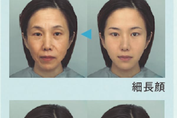 女性の大敵 ほうれい線 できやすさをチェック Nikkei Style 女性の大敵 ほうれい線 できやすさをチェック Nikkei Style