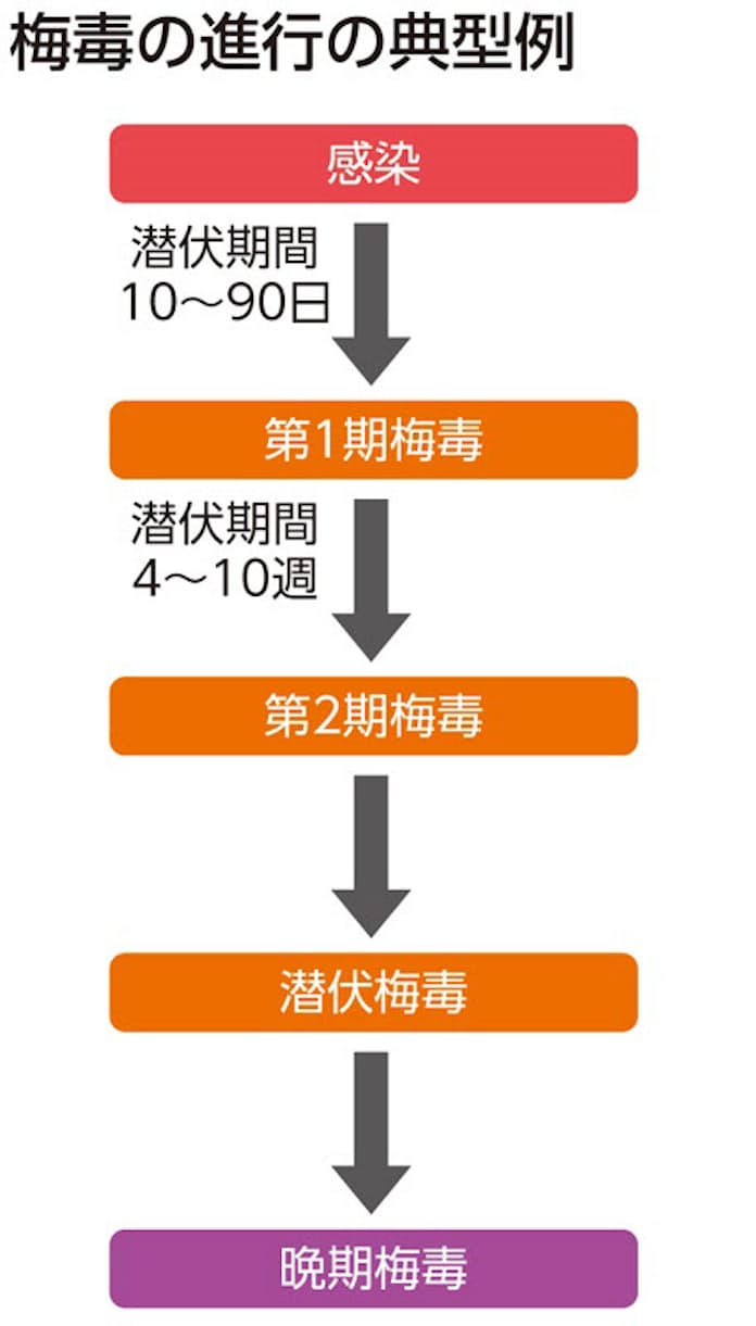 ウクライナ sex-art anal