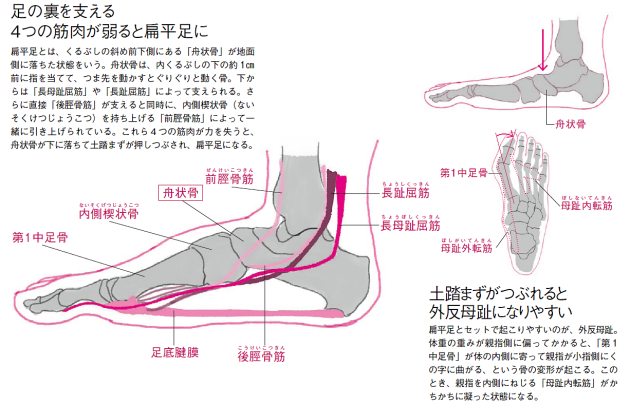 足裏の筋肉を鍛えて扁平足、外反母趾を解消: 日本経済新聞