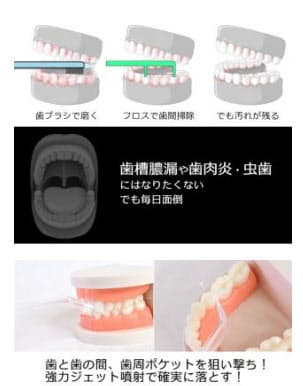 サンコー タンクなしでも使える口腔洗浄器ジェットウォッシャブル を発売 日本経済新聞