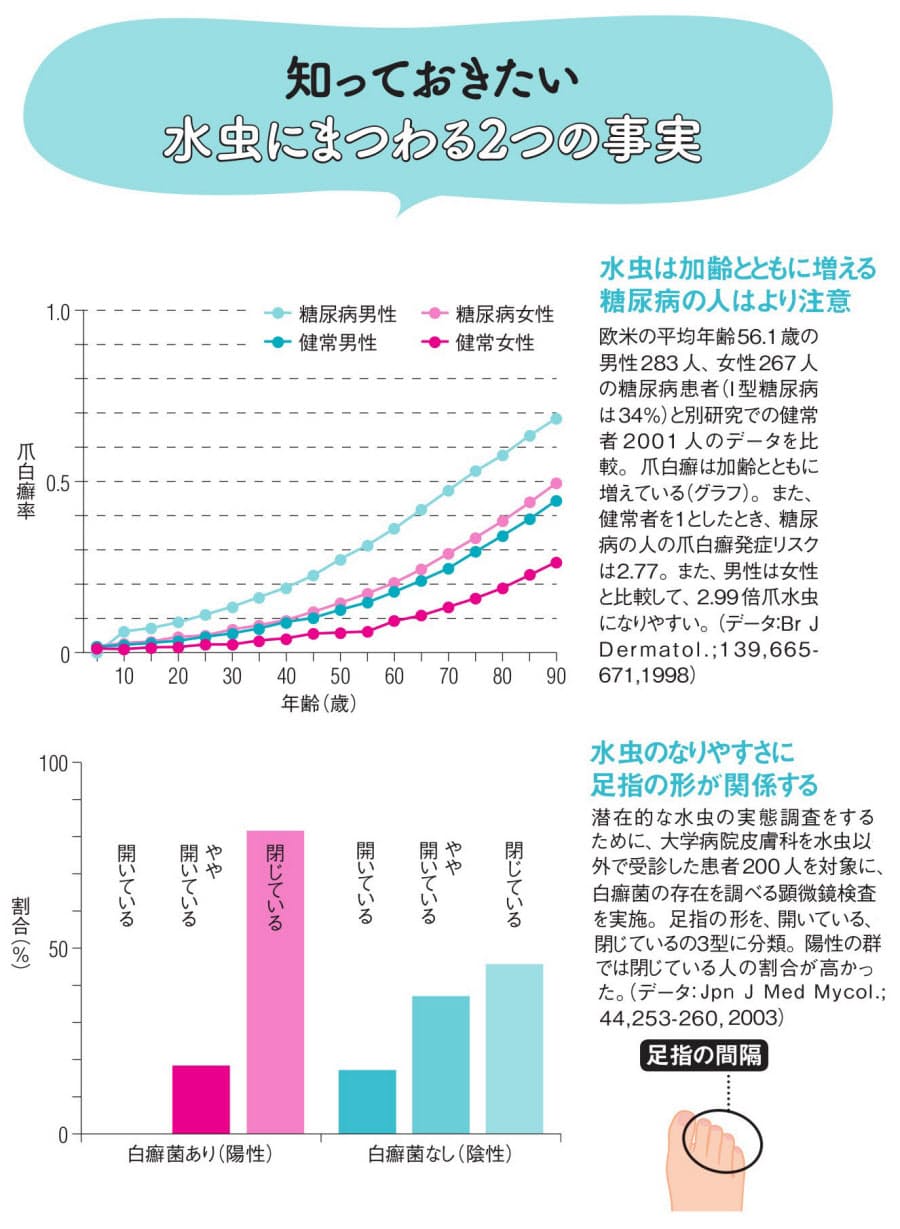 水虫 自己判断で放置は禁物 糖尿病の人は要注意 Nikkei Style 水虫 自己判断で放置は禁物 糖尿病の人は要注意 Nikkei Style