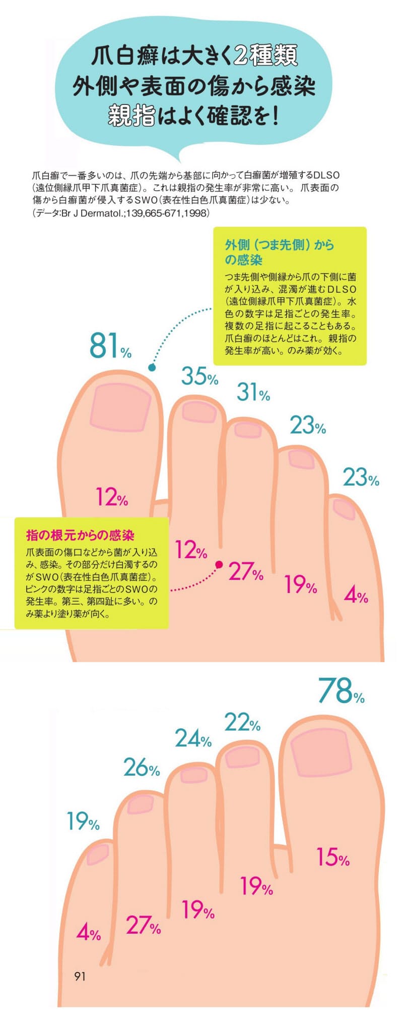 水虫 足を洗う習慣で防ごう 毎日同じ靴は履かない Nikkei Style 水虫 足を洗う習慣で防ごう 毎日同じ靴は履かない Nikkei Style