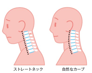 腕のしびれは危険信号 危ない 首こり 対策 Nikkei Style