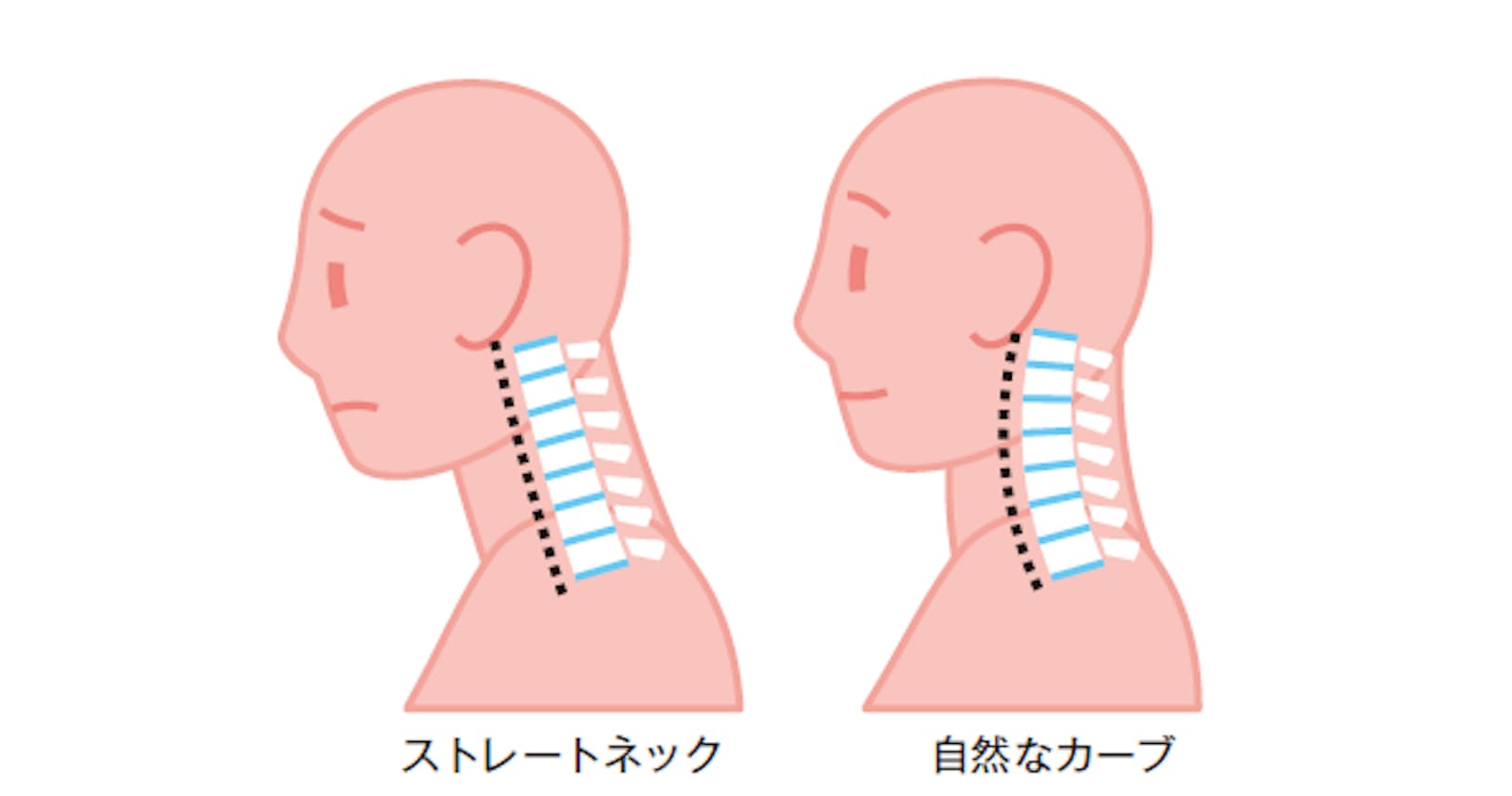 左腕 が 痛い