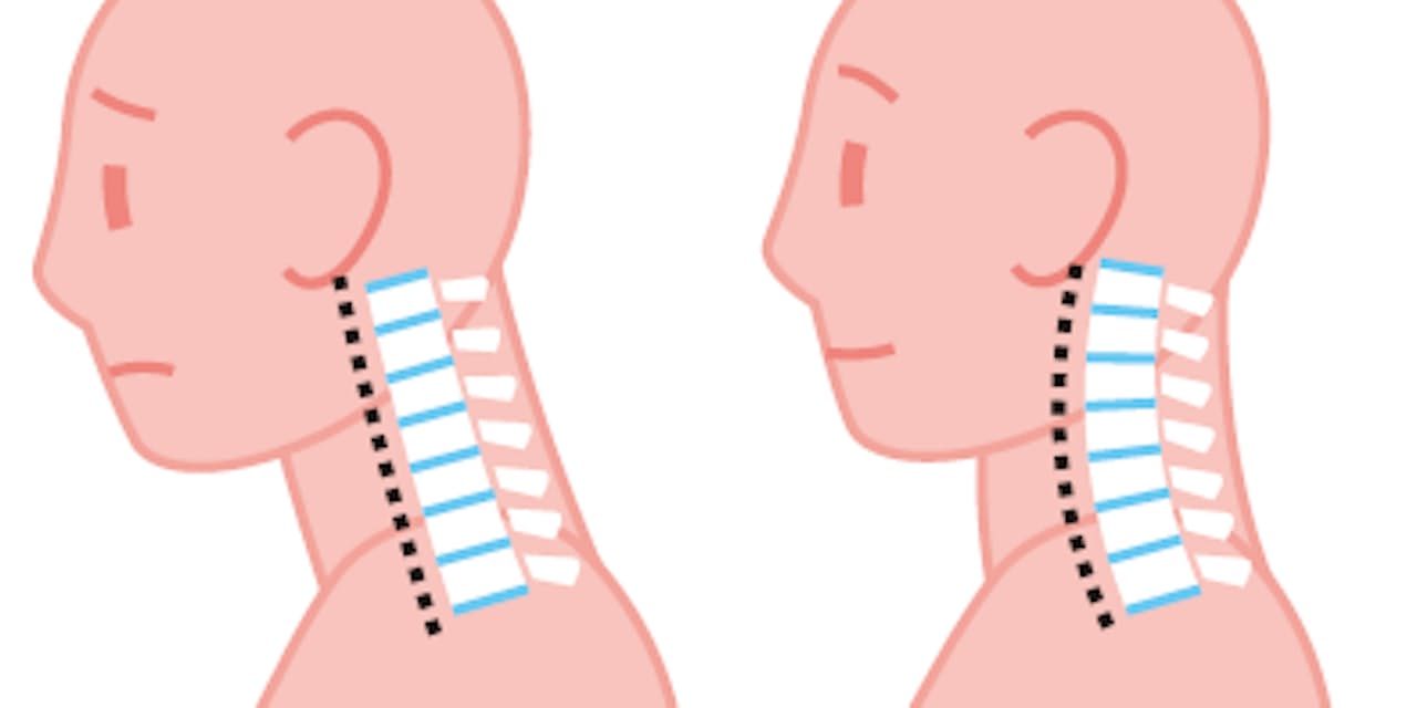 腕のしびれは危険信号 危ない 首こり 対策 Nikkei Style 腕のしびれは危険信号 危ない 首こり 対策 Nikkei Style