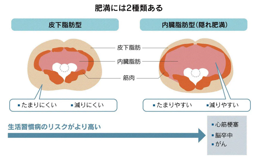 隠れ肥満にご用心 内臓脂肪リスク 細切れ運動で予防 Nikkei Style 隠れ肥満にご用心 内臓脂肪リスク 細切れ運動で予防 Nikkei Style