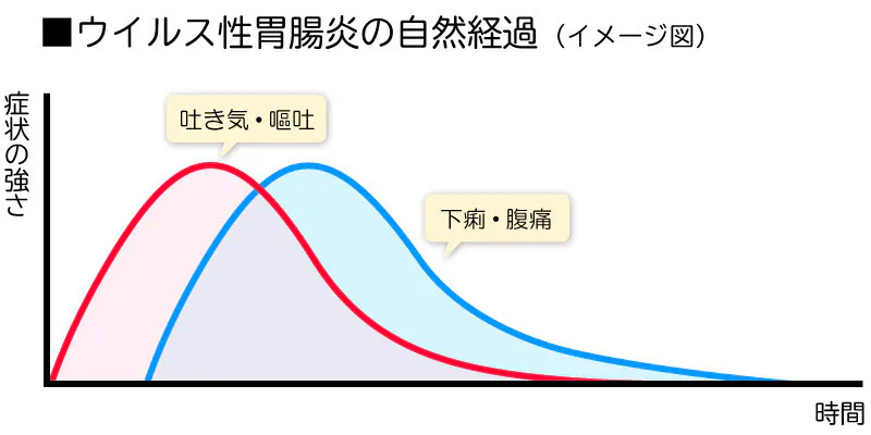 3症状のうち2つそろえばほぼウイルス性胃腸炎 ノロに感染 急な下痢 受診の見極 Nikkei Style