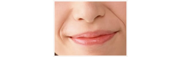 女性の大敵 ほうれい線 できやすさをチェック Nikkei Style 女性の大敵 ほうれい線 できやすさをチェック Nikkei Style