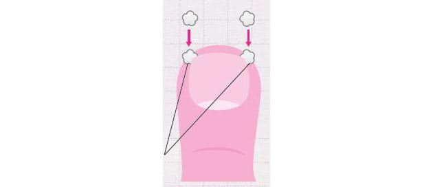 巻き爪 陥入爪はセルフケアで予防を Nikkei Style