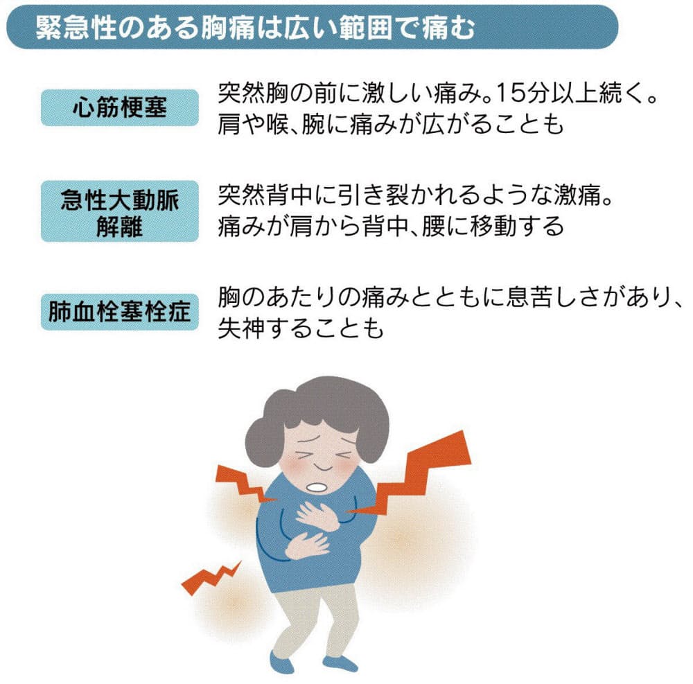 胸の痛み 激しい 広範囲ならすぐ受診 肩や喉も注意 Nikkei Style 胸の痛み 激しい 広範囲ならすぐ受診 肩や喉も注意 Nikkei Style