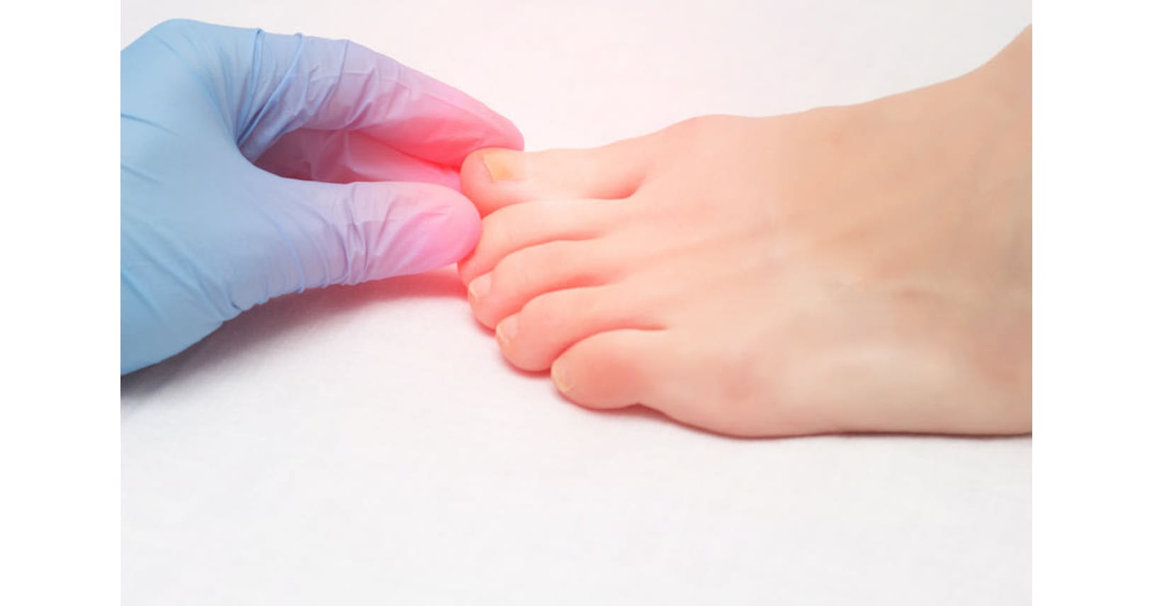 誤解の多い爪水虫 間違ったケアは家族へ感染のリスク Nikkei Style 誤解の多い爪水虫 間違ったケアは家族へ感染のリスク Nikkei Style