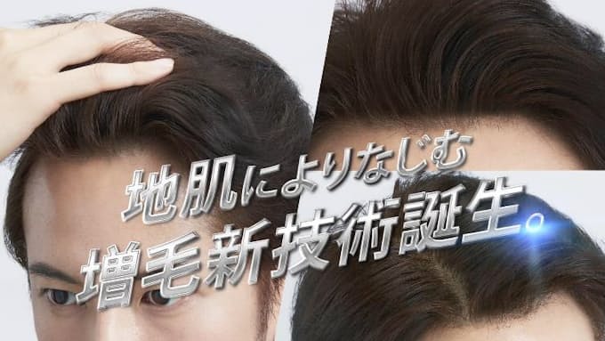 アデランス 男性向け増毛商品 バイタル Ex デュアル バイタル Ex デュアルライン を発売 日本経済新聞