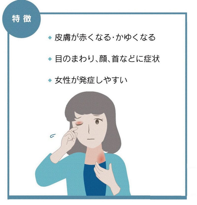 花粉が原因の皮膚炎に注意 冬の乾燥が春の肌荒れ招く Nikkei Style 花粉が原因の皮膚炎に注意 冬の乾燥が春の肌荒れ招く Nikkei Style