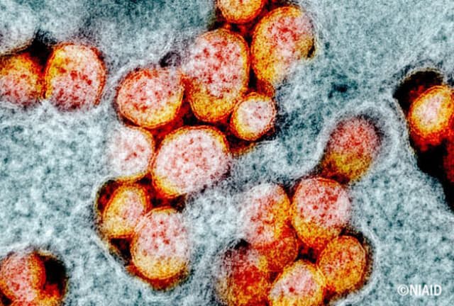 新型コロナウイルスは発症前の患者からも感染を起こす。（画像提供：NIAID）