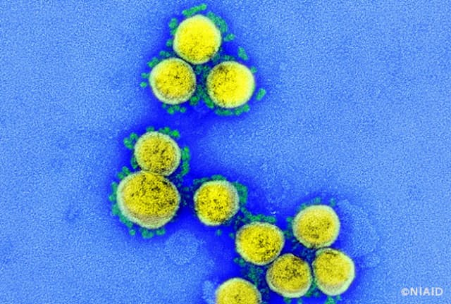 新型コロナウイルスはエアロゾル状態や物質表面でどのくらい感染力を保つのか？（写真：NIAID）