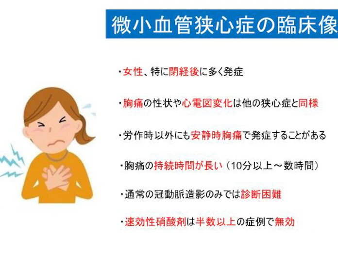 東北大 微小血管狭心症患者で指尖細動脈における血管拡張因子を介した新たな病態を解明 日本経済新聞