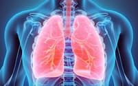 現在、日本人のがん死亡数のトップとなっているのは「肺がん」です。(c)yodiyim-123RF