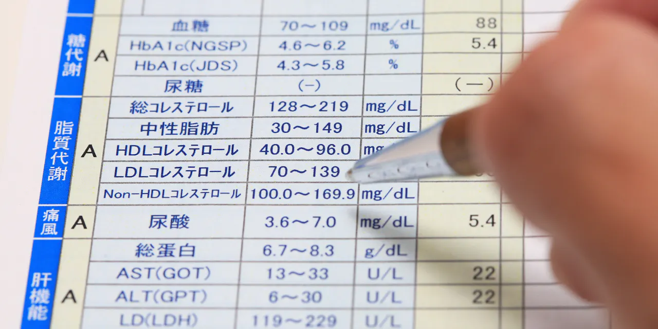 高尿酸値は早めに対処 適正体重 カロリー保とう Nikkei Style