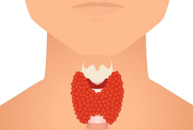 甲状腺は、のど仏の下あたりに、気管の前面を包むようについている。女性は首の真ん中あたり、男性は首の根元に近い場所に位置する。(C)naumas-123RF