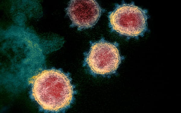 新型コロナウイルスの電子顕微鏡画像（提供:米国立アレルギー感染症研究所）