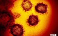 既存のコロナウイルスのように、新型コロナウイルスも夏になると流行は収まる？(C)NIAID