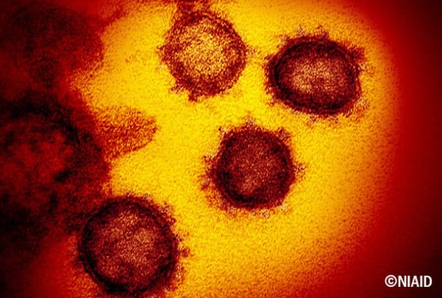 既存のコロナウイルスのように、新型コロナウイルスも夏になると流行は収まる？(C)NIAID