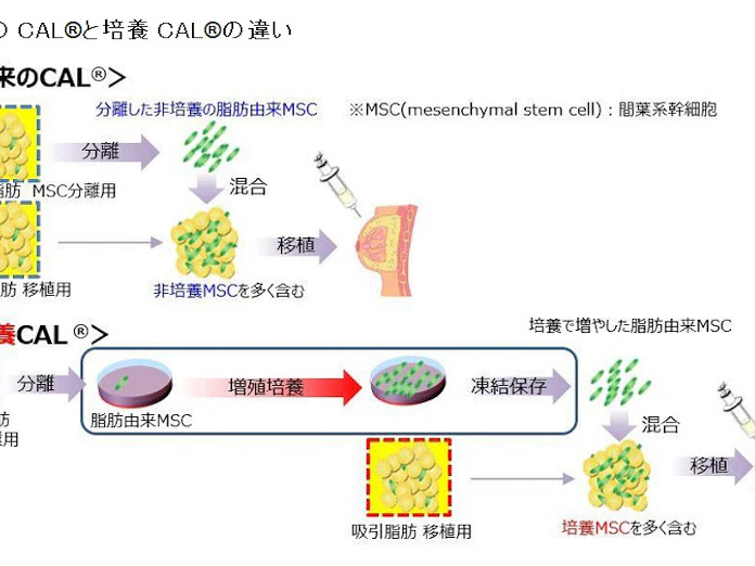 セルポートクリニック横浜 培養脂肪幹細胞を用いた乳房再建治療を開始 日本経済新聞