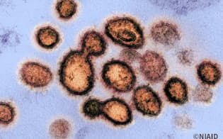 新型コロナウイルスは、一度感染すれば二度と感染しないウイルスではないことが明らかになってきました。（写真提供:NIAID）