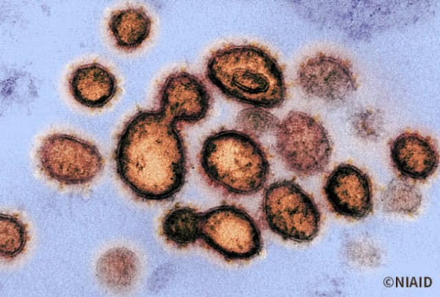 新型コロナウイルスは、一度感染すれば二度と感染しないウイルスではないことが明らかになってきました。（写真提供：NIAID）