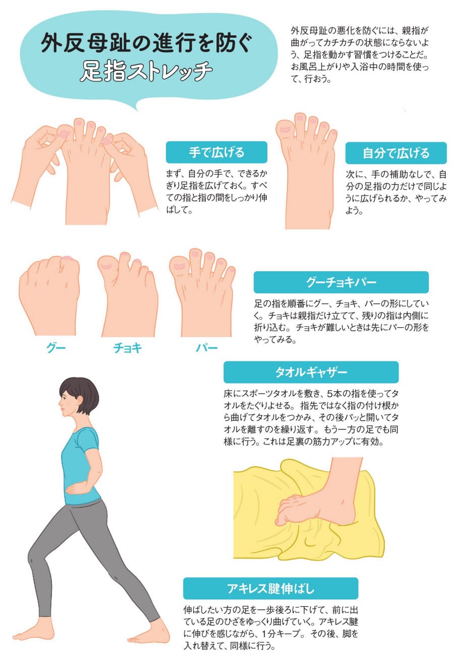 外反母趾を防ぐには 足指ストレッチでやわらかさ保つ Nikkei Style 外反母趾を防ぐには 足指ストレッチでやわらかさ保つ Nikkei Style