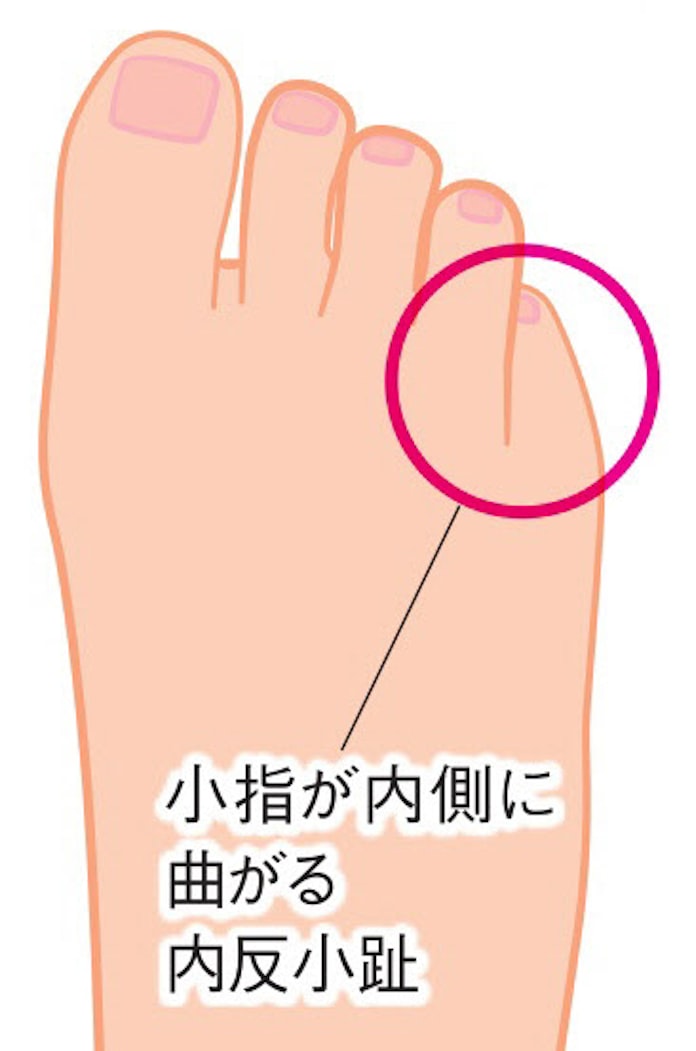 外反母趾を防ぐには 足指ストレッチでやわらかさ保つ 日本経済新聞 外反母趾を防ぐには 足指ストレッチでやわらかさ保つ 日本経済新聞