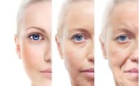 糖化は、美容などの見た目の老化はもちろん、糖尿病、動脈硬化、認知症などとも深く関わっている。(c)Valentina Razumova-123RF