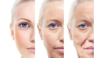 糖化は、美容などの見た目の老化はもちろん、糖尿病、動脈硬化、認知症などとも深く関わっている。(c)Valentina Razumova-123RF