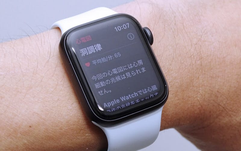 Apple Watchにヘルスケア領域の2つの新機能がソフトウエアのアップデートにより追加された Apple Watchにヘルスケア領域の2つの新機能がソフトウエアのアップデートにより追加された