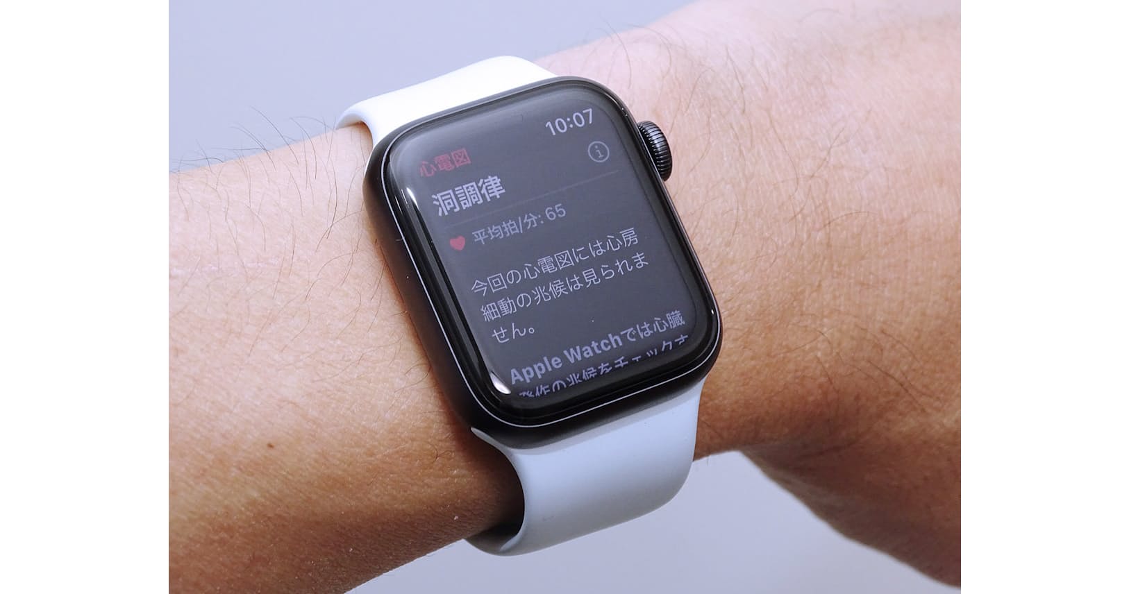 日本でも開始 Apple Watchの心電図機能を使ってみた Nikkei Style